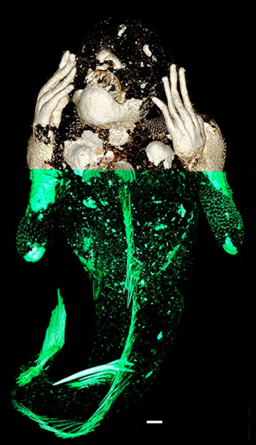 Kết quả xét nghiệm ADN, chụp X quang, chụp CT xác ướp "nàng tiên cá" Nhật Bản - 2