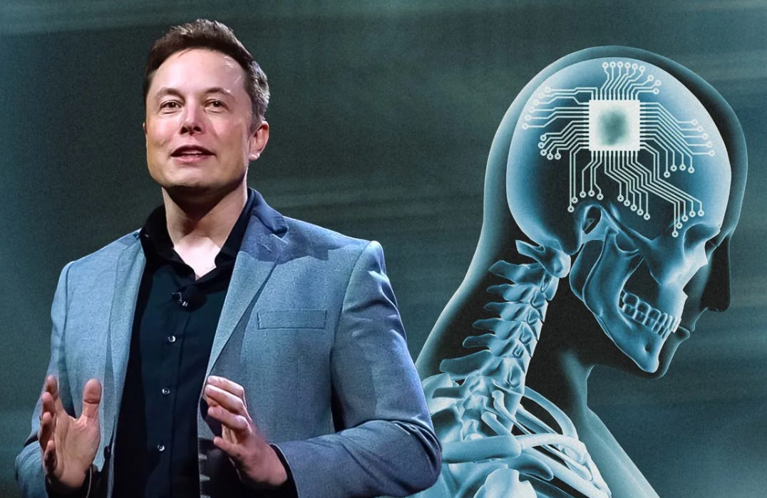 Elon Musk muốn cấy chip vào não người, vì sao Mỹ liên tục từ chối? - 1