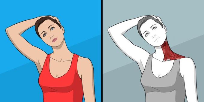 Tổng hợp 5 cách cải thiện thoái hóa cột sống cổ hiệu quả - 1