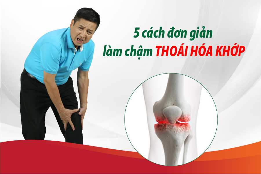 5 cách đơn giản làm chậm thoái hóa khớp - 1