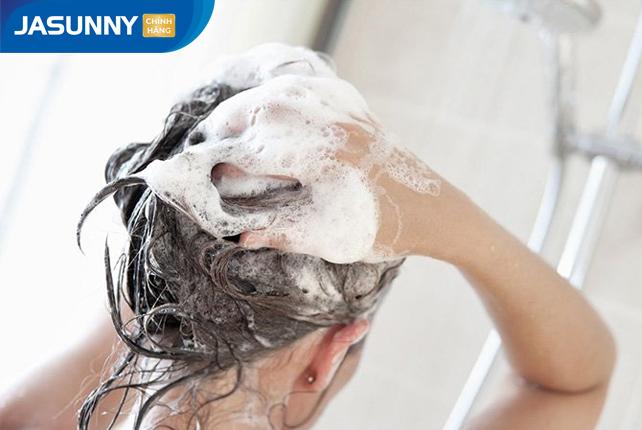 Gàu ngứa dai dẳng - &#34;khắc tinh&#34; mùa thu đông của nam giới quay trở lại! - 2