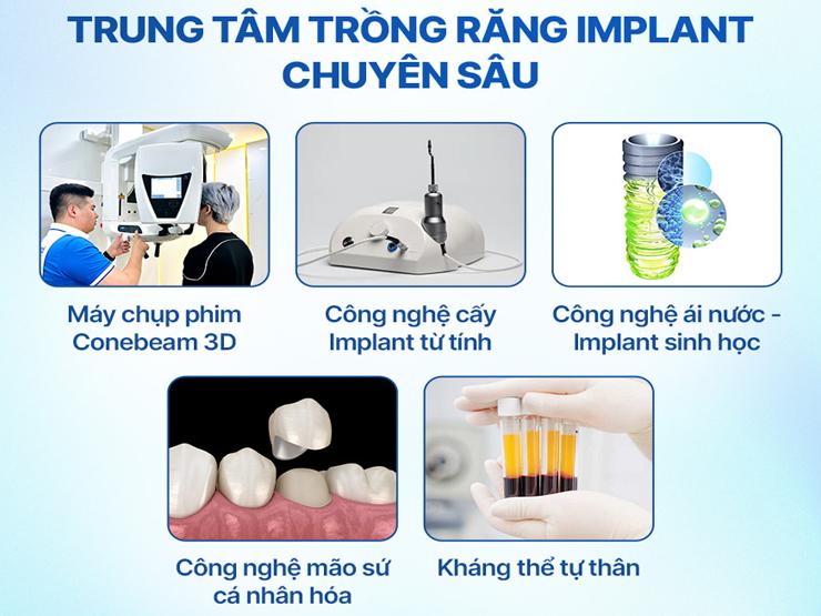 Review Nha Khoa ViDental Implant - Địa chỉ trồng răng không đau, hiệu quả - 1
