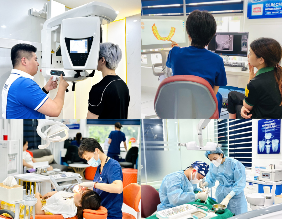 Review địa chỉ niềng răng tại Hà Nội chất lượng - Nha khoa ViDental  - 4