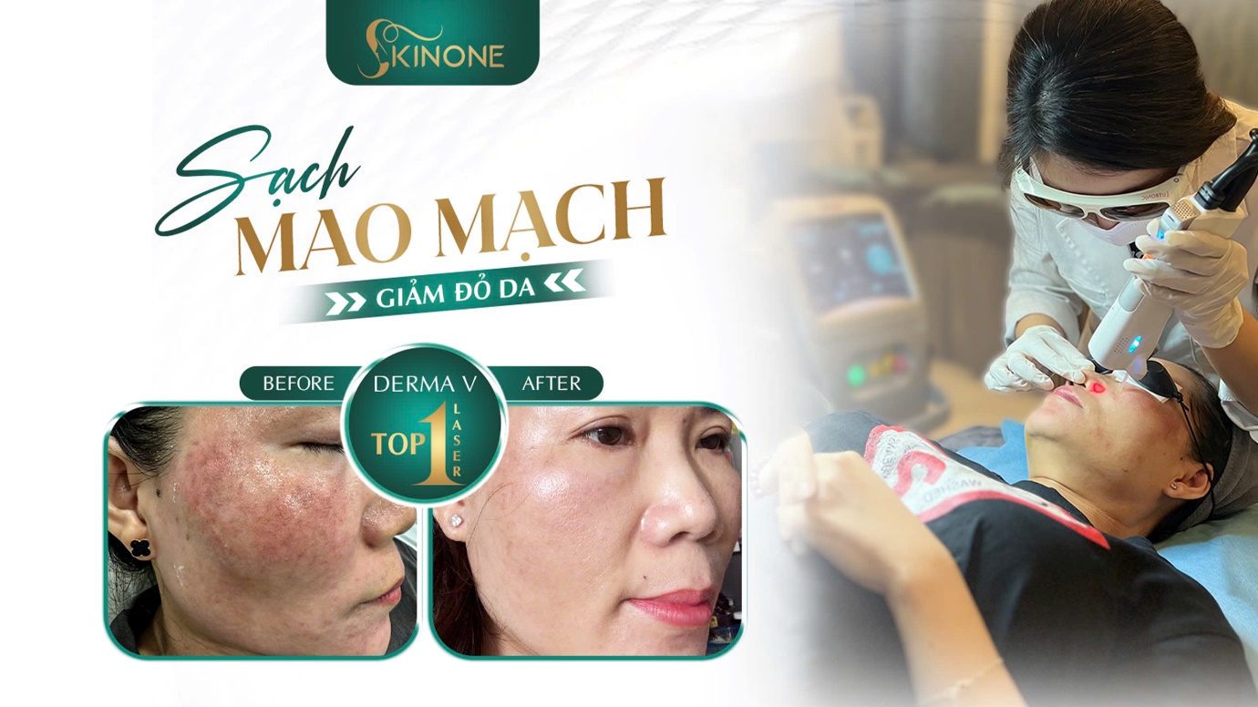 SkinOne - Trung tâm điều trị mao mạch đầu tư đầy đủ trang thiết bị công nghệ mới hiện nay - 3