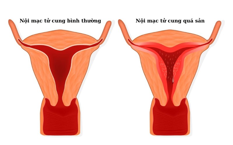 Ra máu âm đạo sau mãn kinh, xử lý chậm 1 bước có thể hóa ung thư - 1