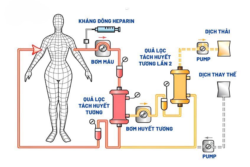 Hiểu đúng về công nghệ lọc huyết tương bằng hai quả lọc  - 1