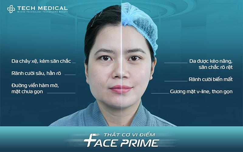 Thắt cơ vi điểm - xu hướng trẻ hóa ít xâm lấn trong năm 2026 - 2