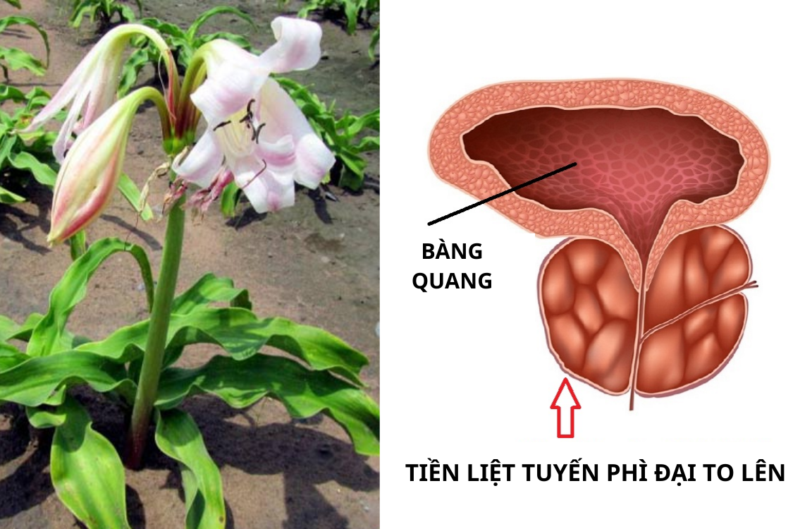 Loại cây “dân dã” mọc đầy bờ bụi, được ví như “khắc tinh” của phì đại tuyến tiền liệt - 1