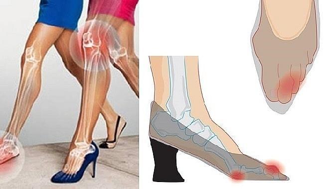 Cảnh báo thói quen cực nguy hiểm khiến xương khớp “lao dốc” không phanh - 2