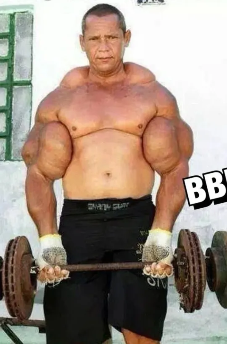 "Người khổng lồ Hulk đời thực" bắp tay có chu vi 74cm, qua đời vì sử dụng thuốc tự chế - 3