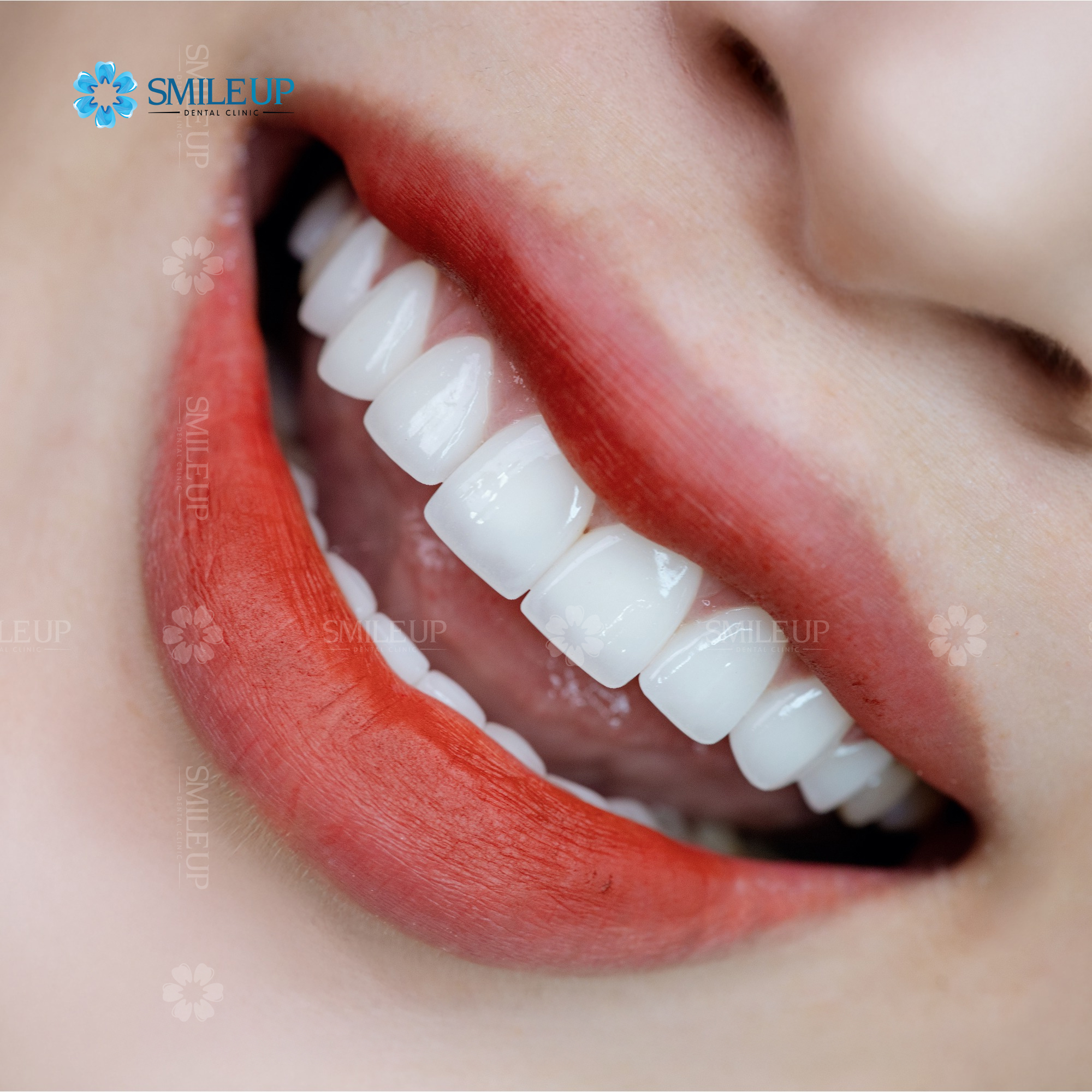 Kiều bào về nước làm răng sứ: Khi chi phí không còn là thước đo duy nhất - 2