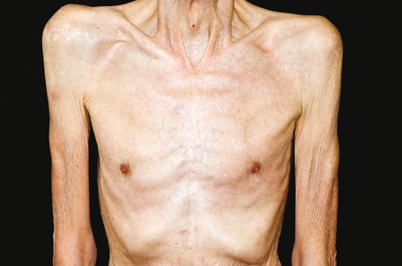 Đừng bỏ qua: 3 biểu hiện lạ ở người đau nhức xương khớp cảnh báo cơ thể đang suy kiệt - 1