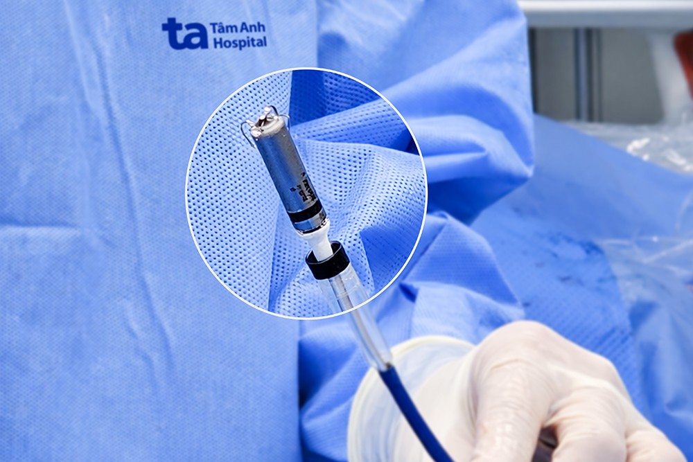 Bệnh viện Tâm Anh triển khai kỹ thuật tạo nhịp không dây thế hệ mới đầu tiên tại Việt Nam - 4