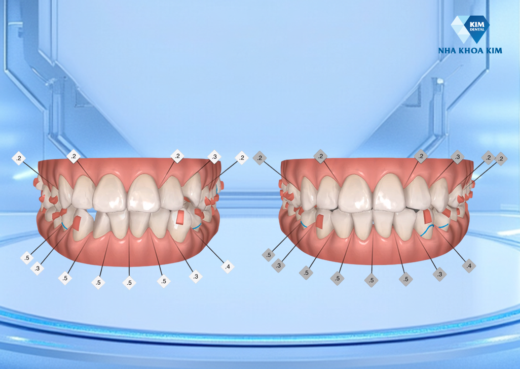 Điều gì tạo nên sự khác biệt của một hệ thống nha khoa nổi tiếng? - 3
