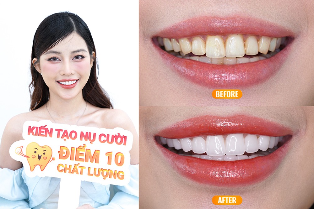 Xu hướng làm đẹp khi về nước: Vì sao nhiều kiều bào tin tưởng Parkview Dental? - 3