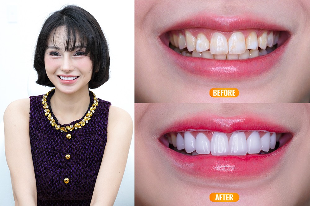 Xu hướng làm đẹp khi về nước: Vì sao nhiều kiều bào tin tưởng Parkview Dental? - 4