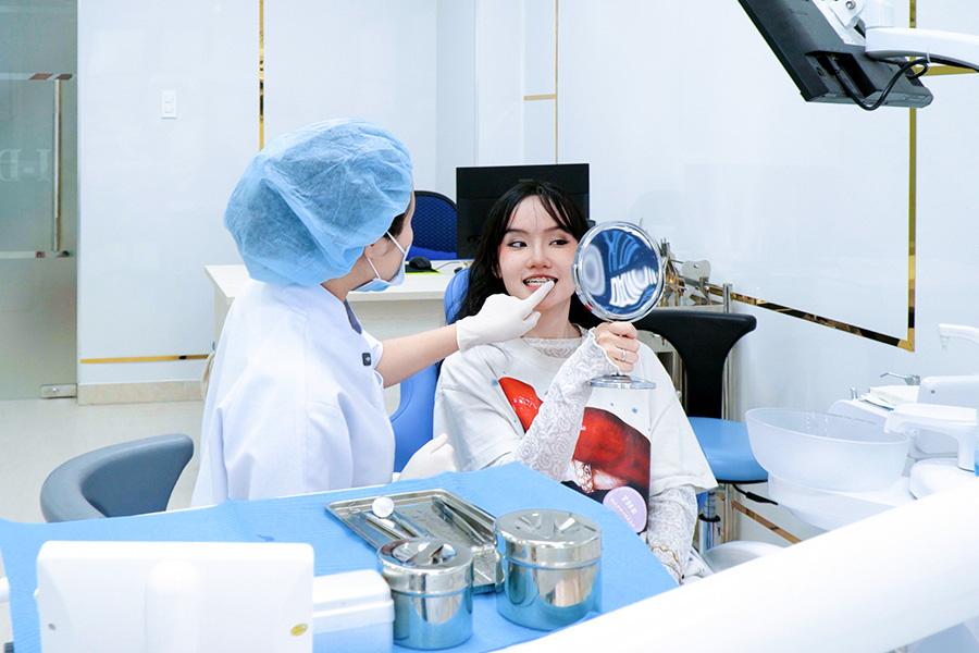 Niềng răng hô có cần nhổ răng không? Chuyên gia giải đáp - 3