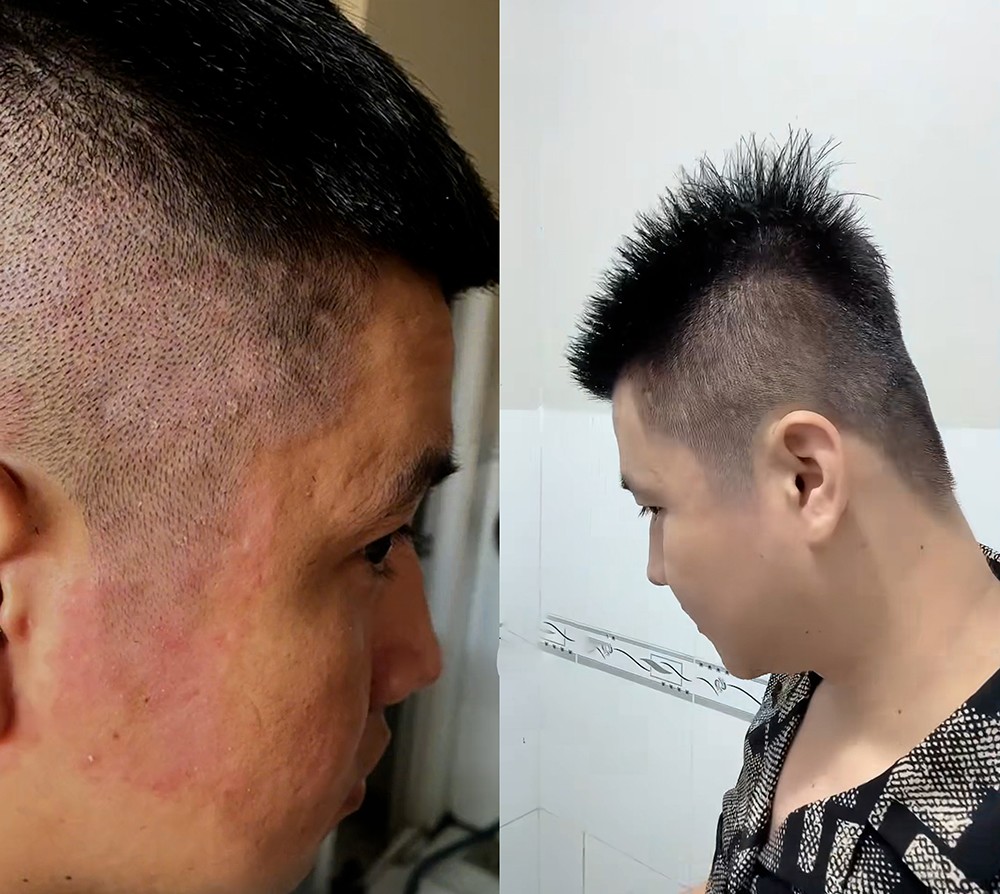 Xu hướng chăm sóc da đầu mới: Sạch gàu bền vững từ Hương Nhu, Đỗ Tùng - 1