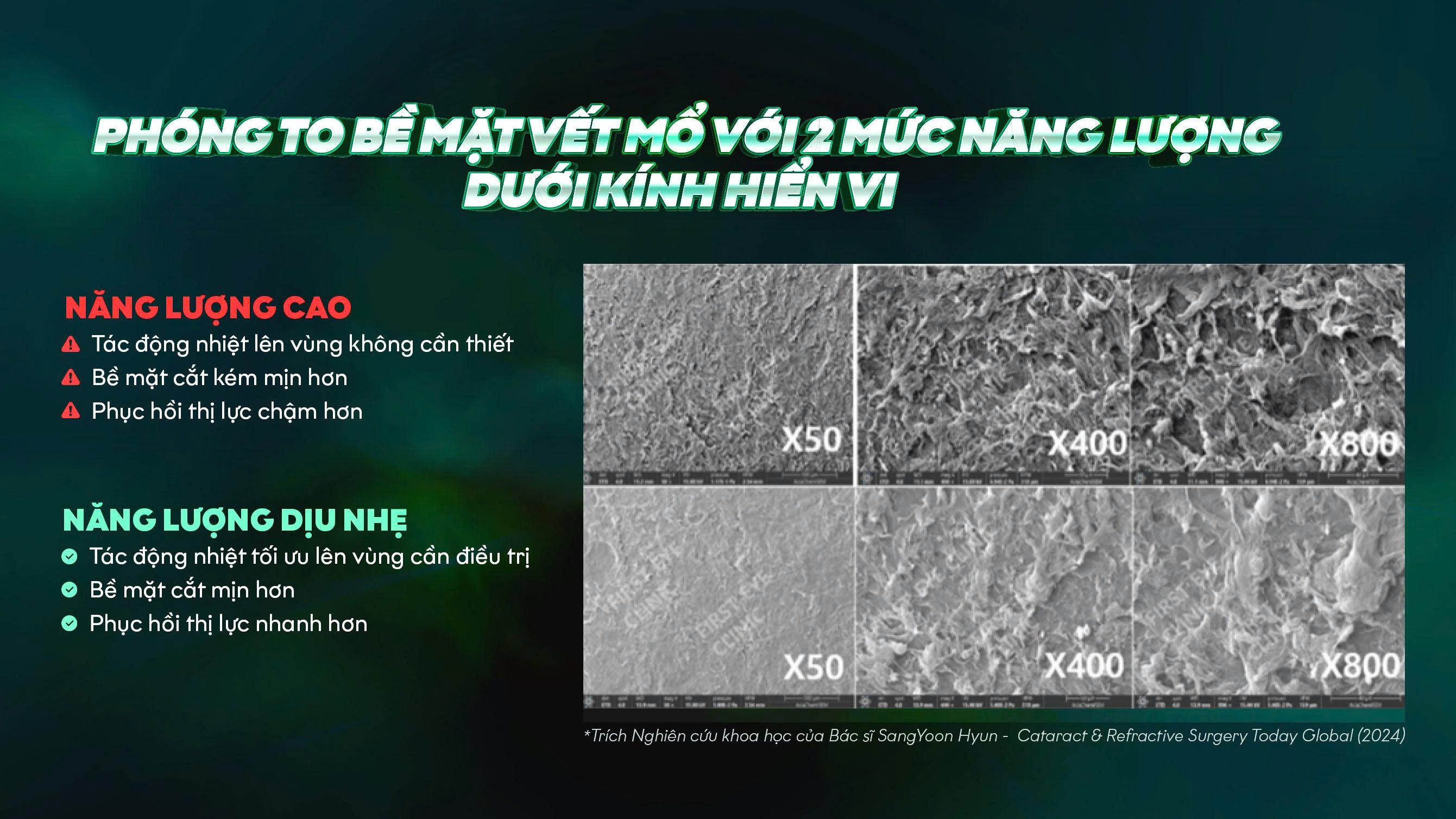 Xóa cận vết mổ nhỏ và sự phát triển hướng đến bảo tồn mô giác mạc - 2