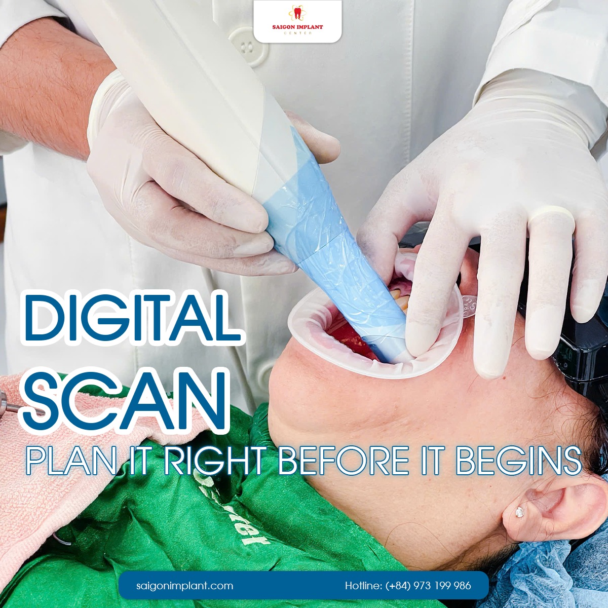 Nha khoa Sài Gòn Implant giải mã quy trình sau một ca cấy ghép Implant - 2