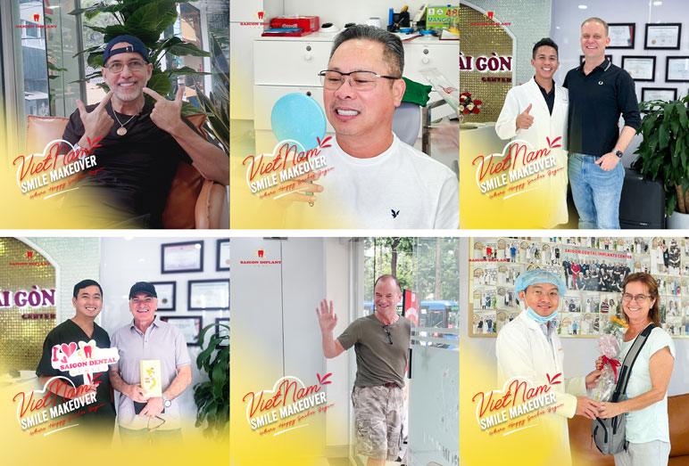 Nha khoa Sài Gòn Implant giải mã quy trình sau một ca cấy ghép Implant - 5