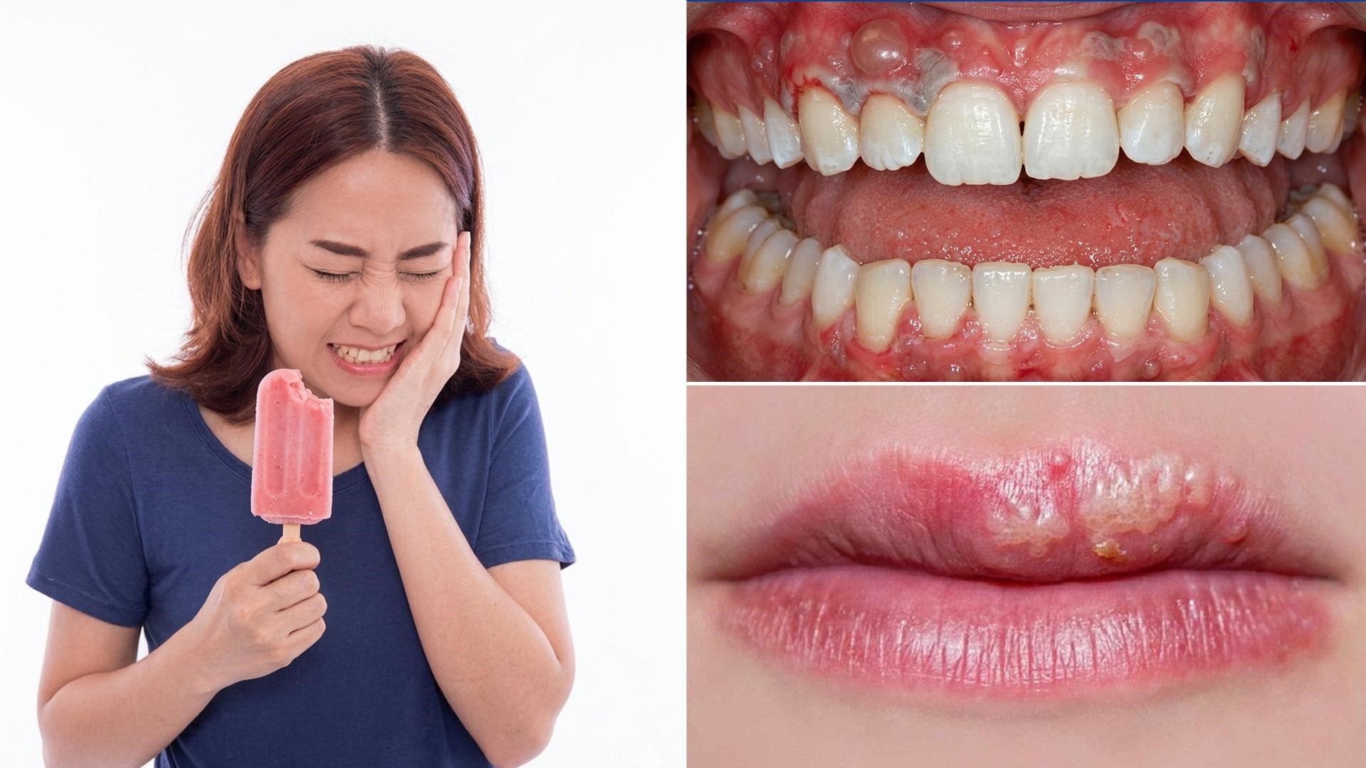 Nên tẩy trắng răng tại nhà hay đến nha khoa? - 2