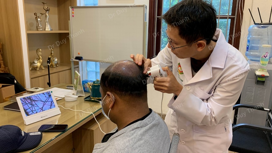 Dr Duy Thành hướng dẫn cách chăm sóc sau cấy tóc tự thân - 2