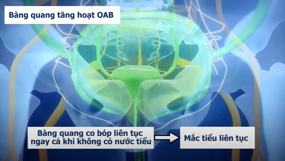 4 loại quả đặc sản mùa hè càng ăn bàng quang càng “khóc thét”! - 4