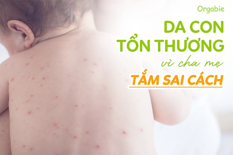 6 sai lầm khi tắm cho trẻ khiến da bé tổn thương nghiêm trọng - 2