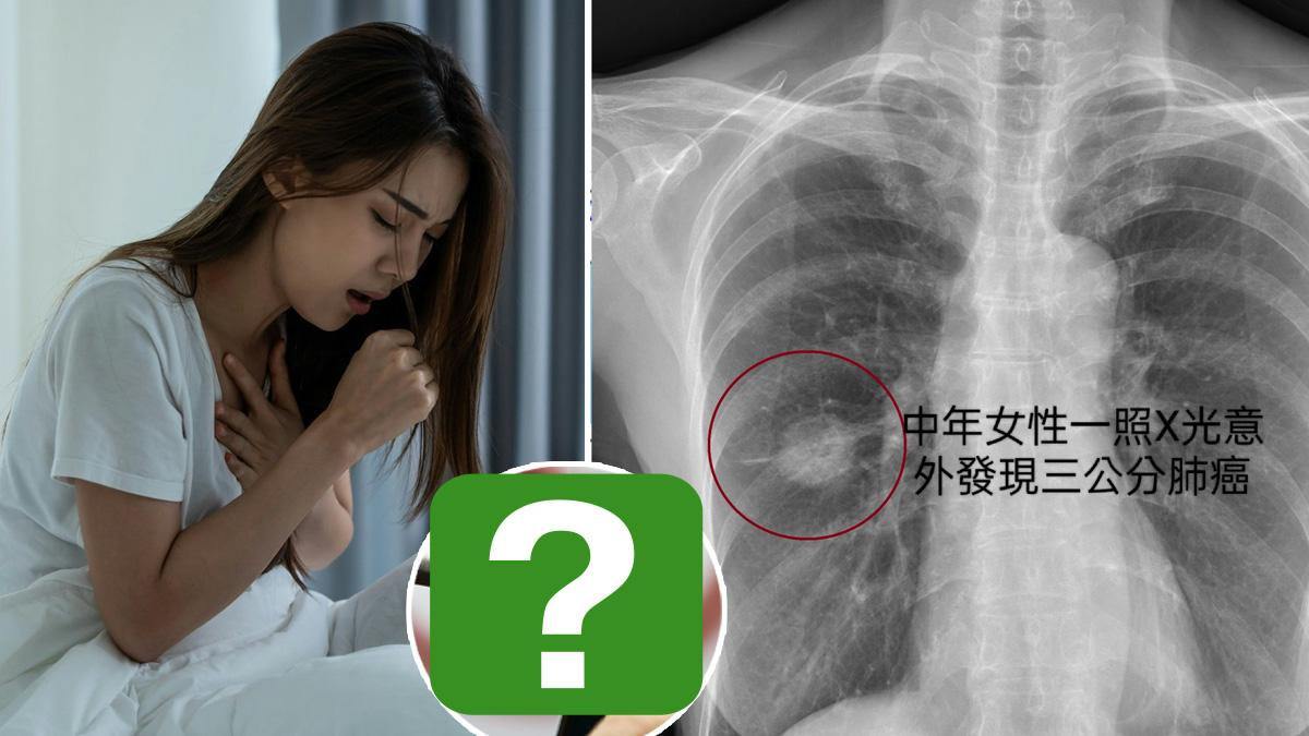 Vợ chồng ung thư phổi, con trai ho không dứt, nguyên nhân khiến ai cũng giật mình - 1