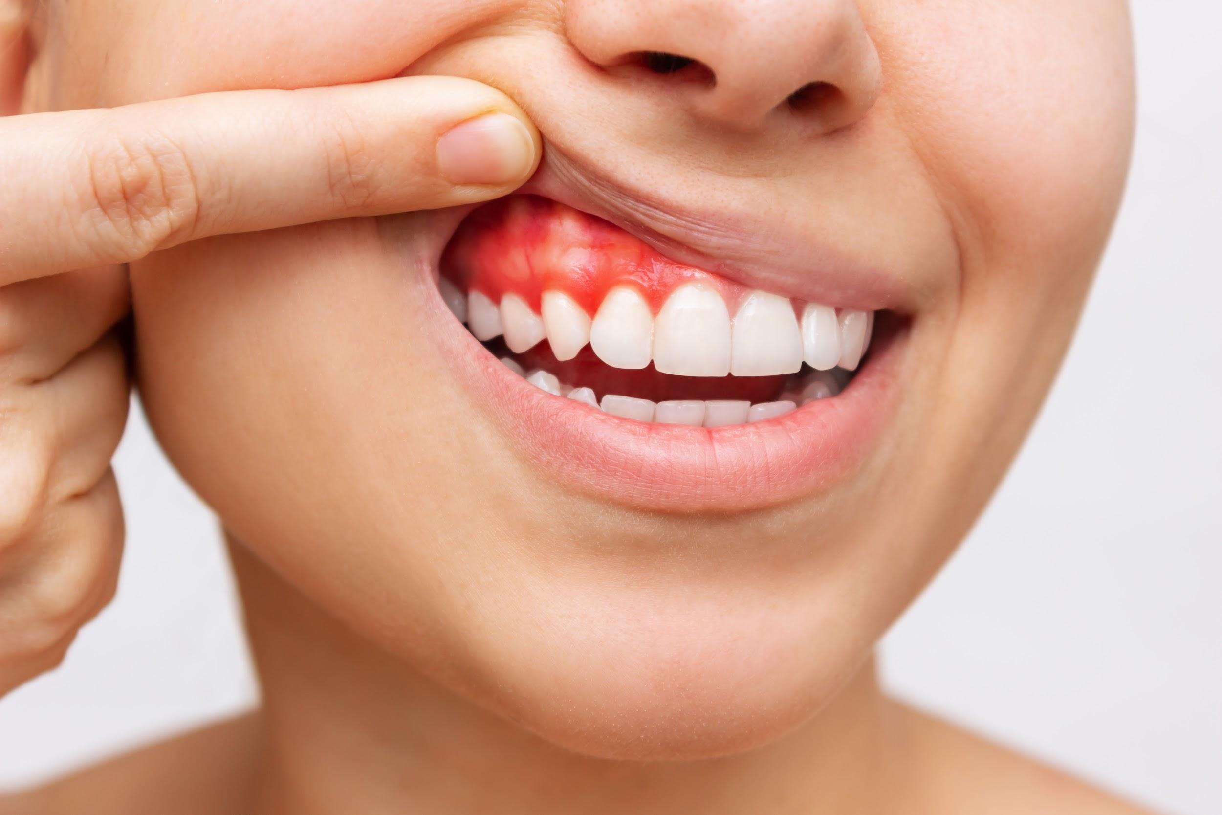 Sức khỏe răng miệng – Nền tảng của cơ thể khỏe mạnh - 2