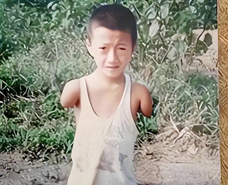 “Sọ Dừa” đời thực: Từ “đồ bỏ đi” thành triệu phú tự thân - 2