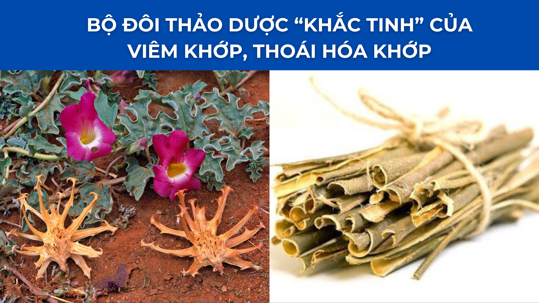 “Tái sinh” khớp gối với 2 món ăn được người xưa truyền tai như bài thuốc bổ dưỡng phục hồi xương khớp - 3