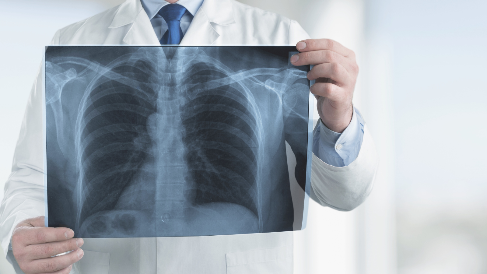 Uống trà xanh có thực sự tốt cho phổi? Câu trả lời khiến nhiều người bất ngờ! - 4