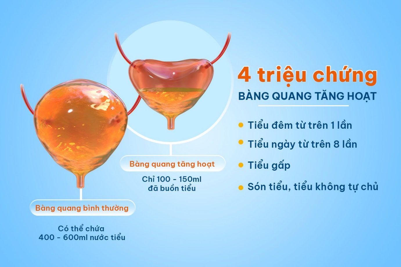 4 sai lầm khi uống nước đang "tra tấn" bàng quang, khiến bạn đi tiểu “mất phanh” từ sáng đến tối - 2