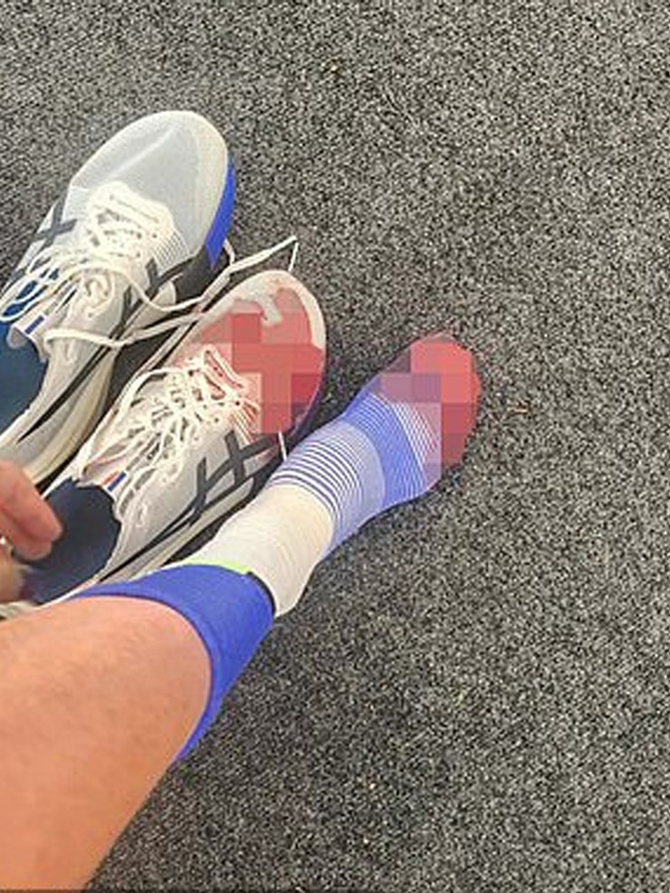 Người đẹp chạy 42km với “chân như bị xé toạc” ở London Marathon - 1