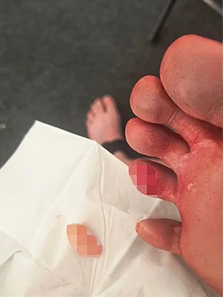 Người đẹp chạy 42km với “chân như bị xé toạc” ở London Marathon - 2