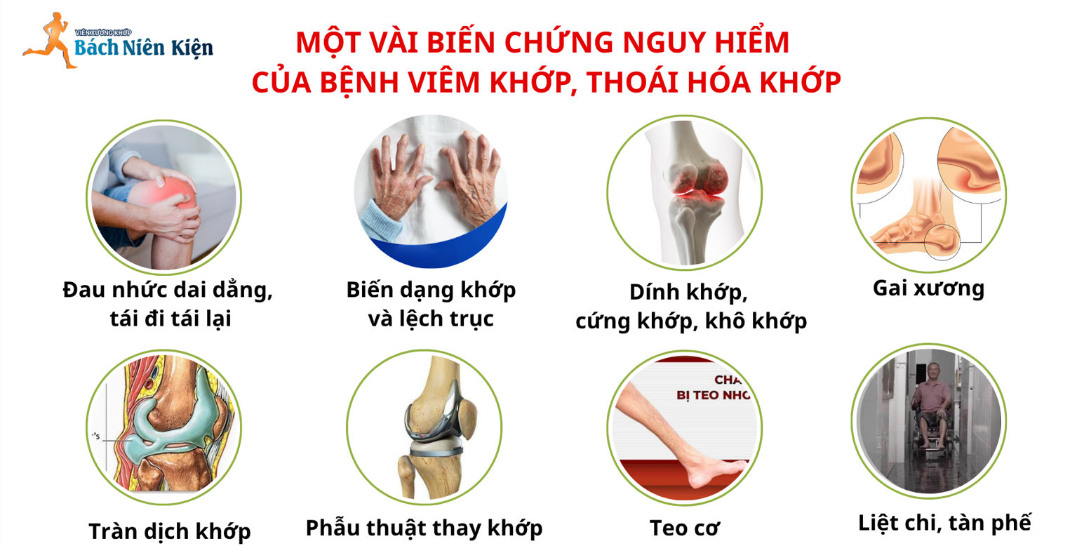 3.000 công nhân tại Bắc Ninh nguy cơ bị đau khớp được Dược phẩm FOBIC tư vấn sớm. - 2