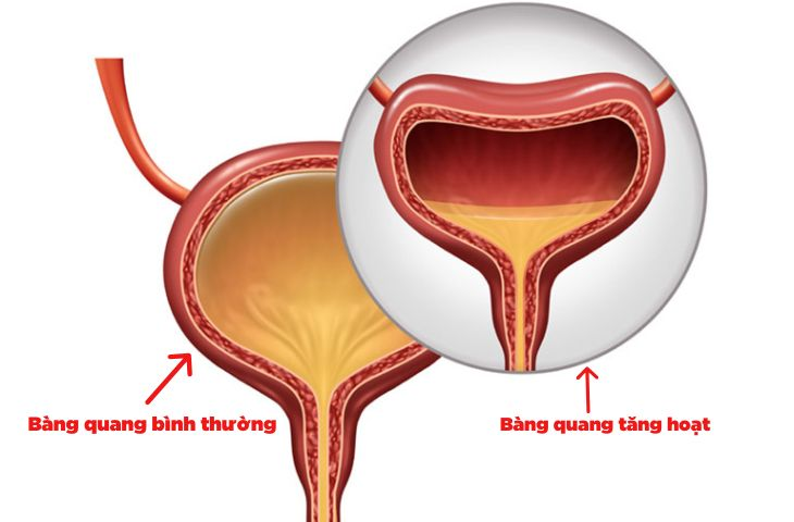 5 món canh “mát ruột” ngày hè nhưng ăn tối muộn dễ khiến cả đêm mất ngủ vì buồn tiểu - 3
