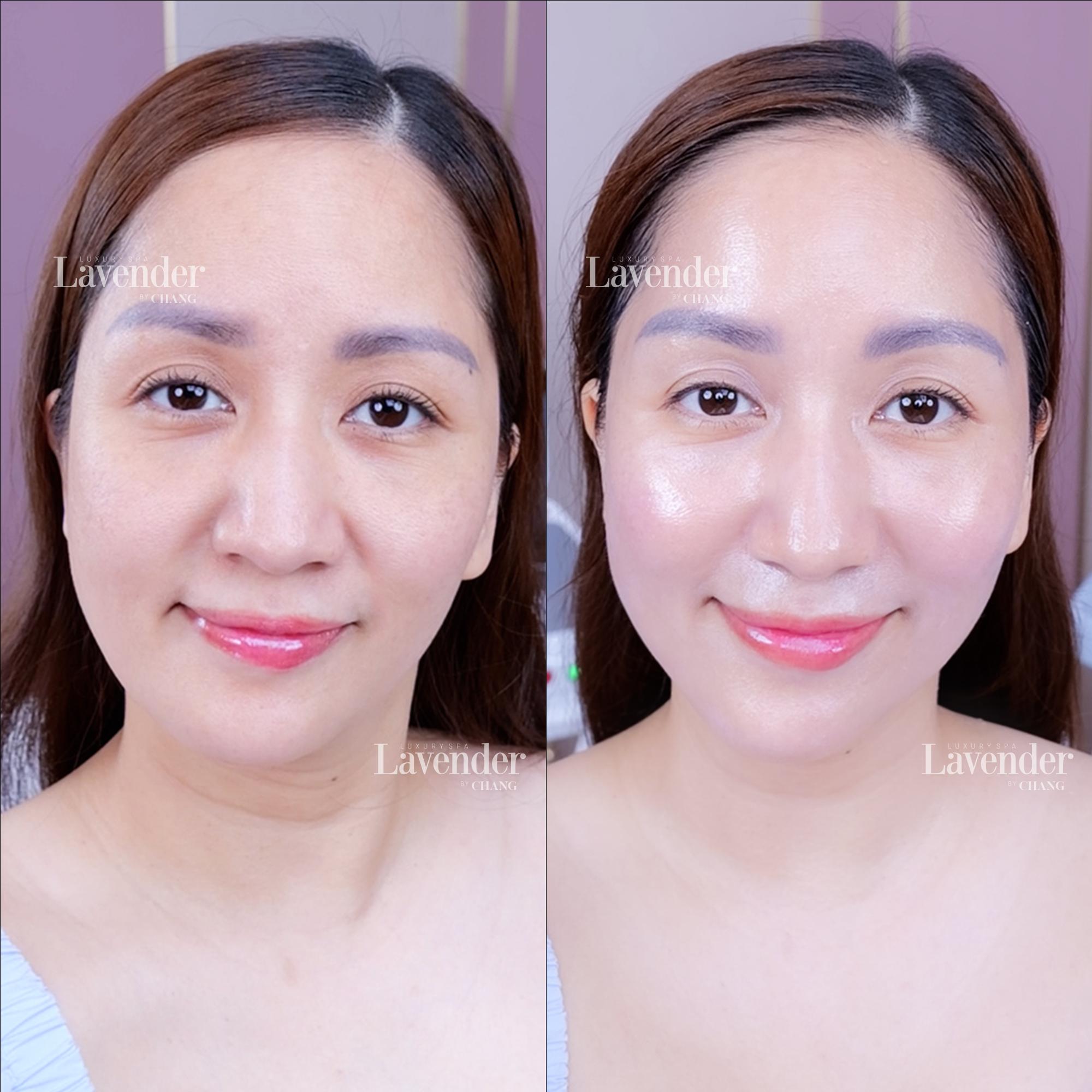 Luxury Spa Lavender By Chang Sài Gòn có thực sự xứng tầm 5 sao? - 3