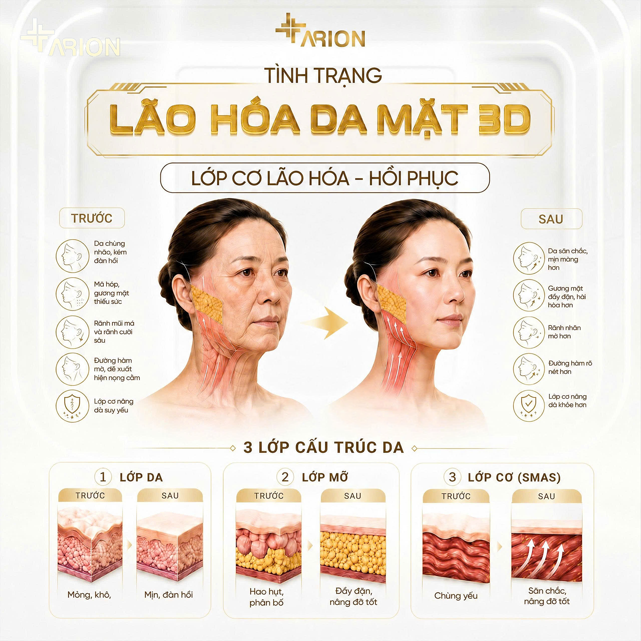 Những lợi ích vượt trội của nâng cơ nội sinh đa tầng Facial Lift đối với làn da và đường nét gương mặt - 2
