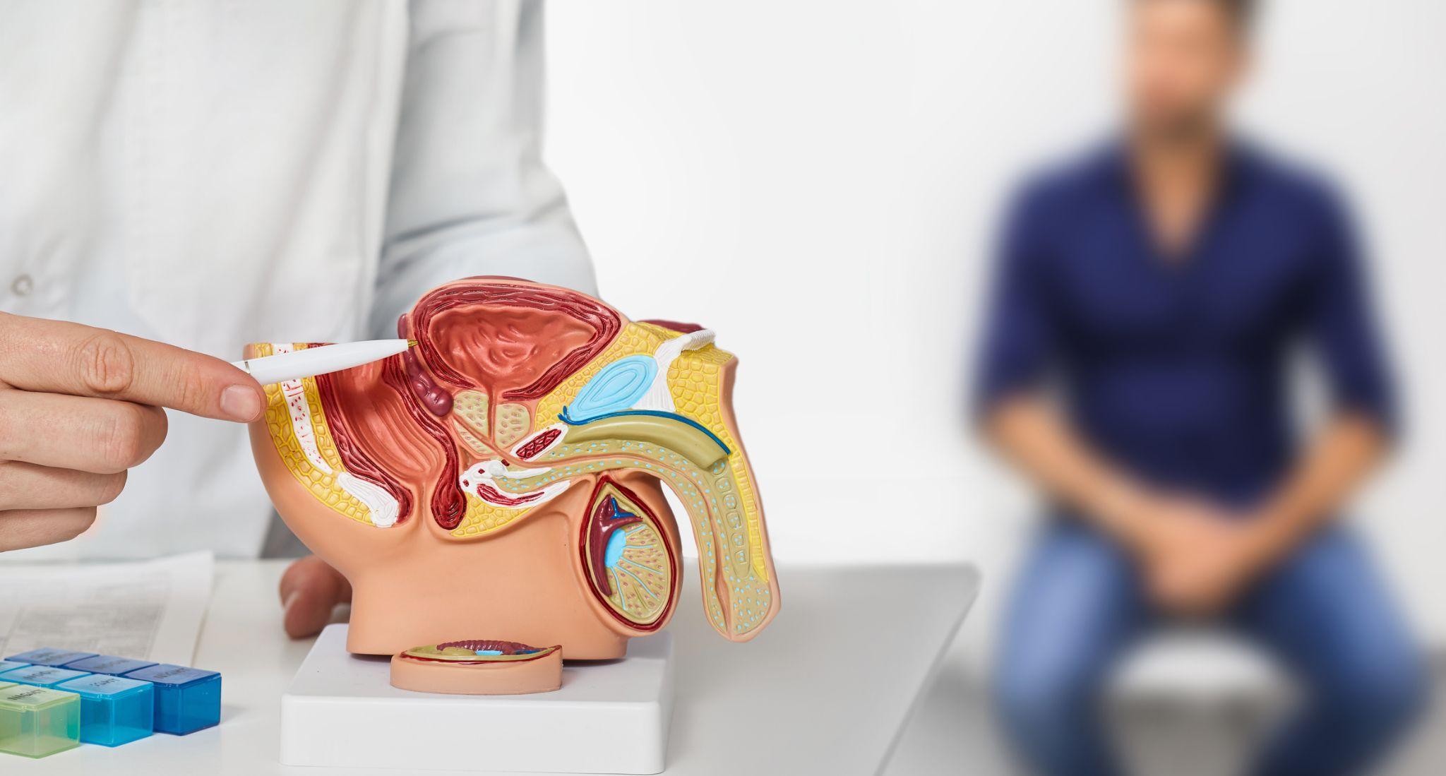 3 dấu hiệu “lạ” khi đi tiểu cảnh báo phì đại tiền liệt tuyến, nam giới chớ xem nhẹ! - 3