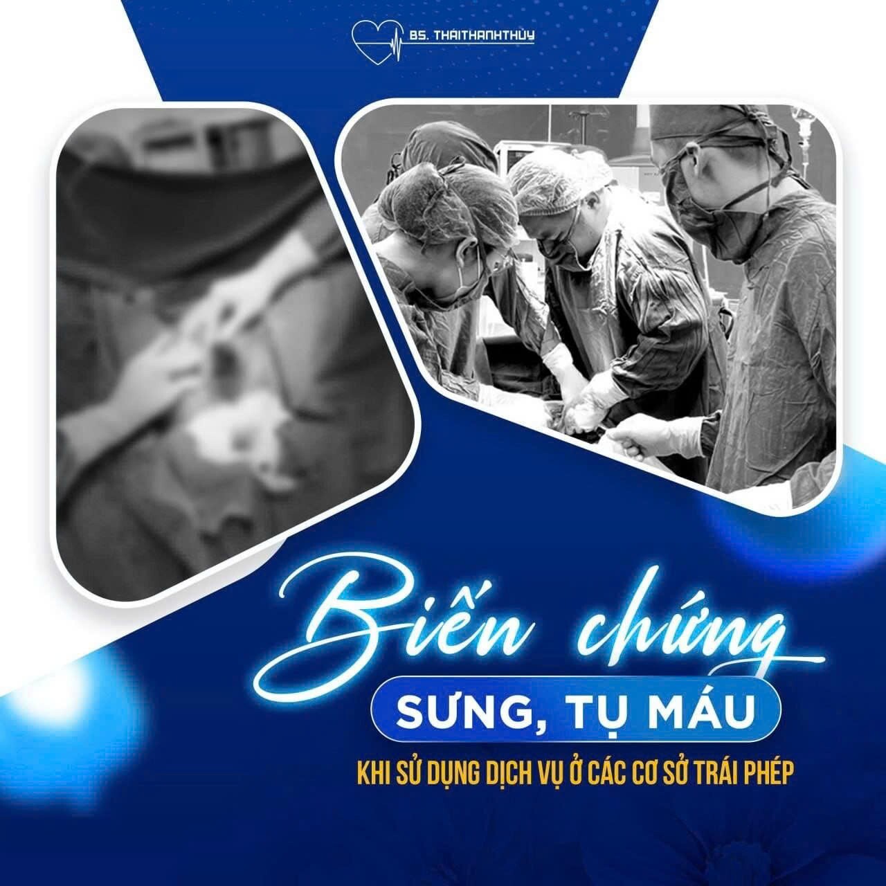 Những nguy cơ khi tân trang vùng kín tại các cơ sở không được cấp phép - 2