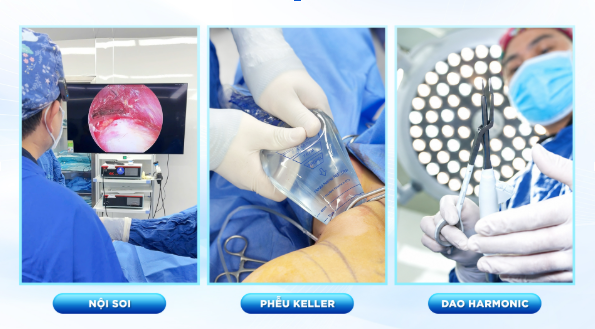 Nâng ngực Tissue Preservation tại Bệnh viện Thẩm mỹ Gangwhoo – Giải pháp nâng ngực trong 30 phút - 2