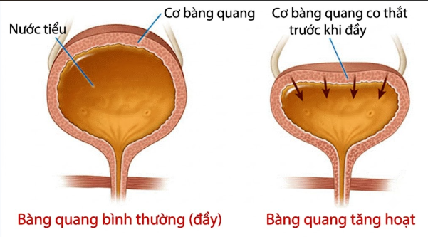 Đây là nhóm người cần tránh uống trà đá giải nhiệt mùa hè! - 2