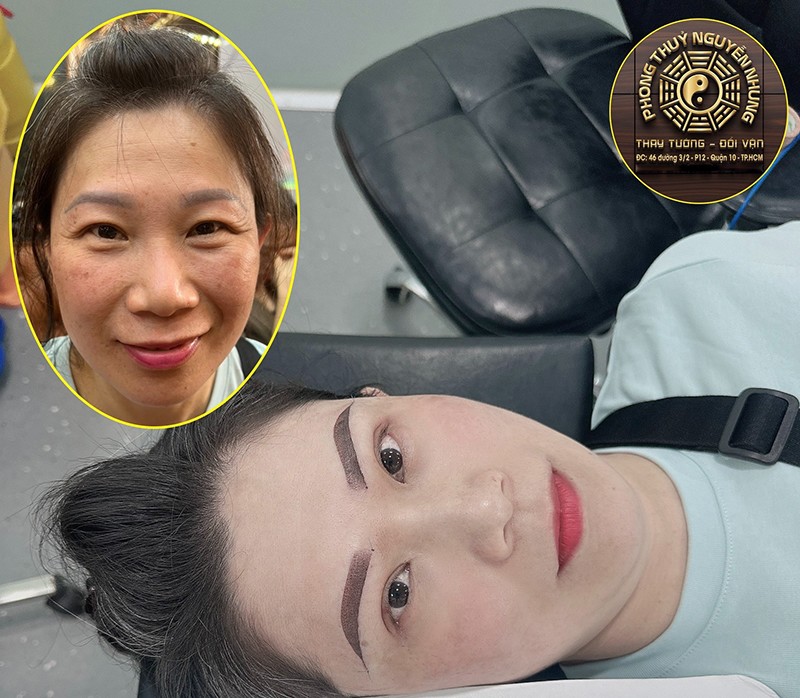Làm chân mày đẹp tại Thẩm mỹ viện Nguyễn Nhung - 1