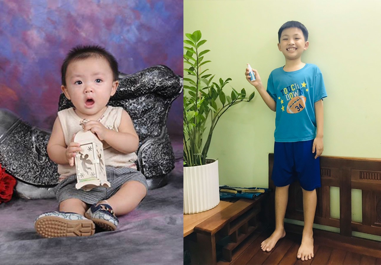 Trẻ mất 20cm chiều cao tối ưu, nguy cơ thấp còi chỉ vì lý do đơn giản này - 5