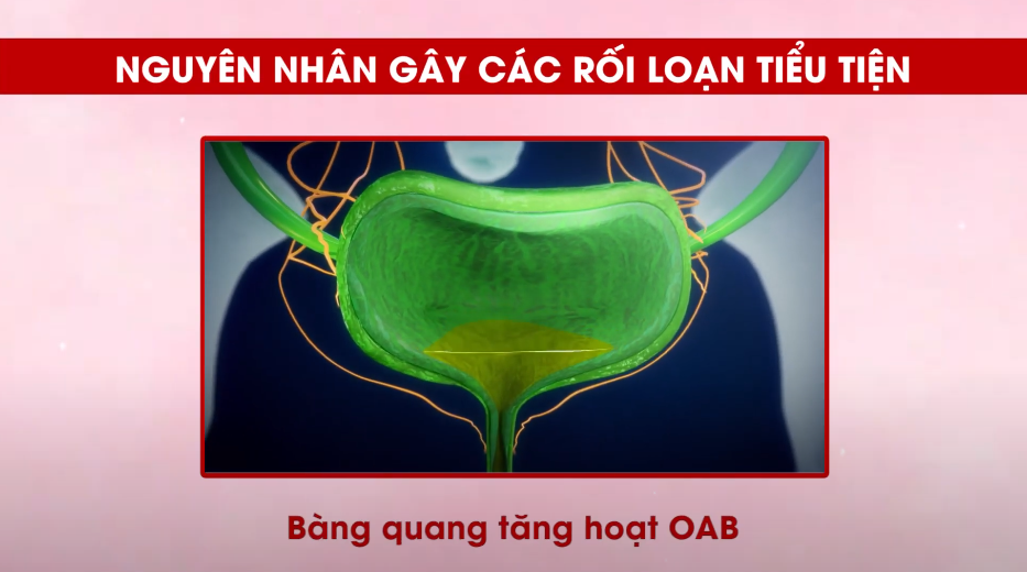 Chứng bệnh lạ khiến người bị đi tiểu liên tục 20 lần, gây bất hòa gia đình! - 2