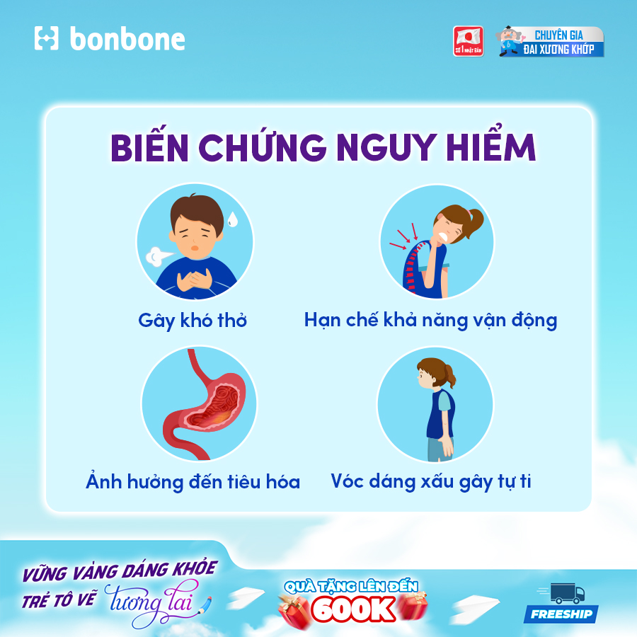 Phụ huynh và nỗi lo trẻ siêu vẹo cột sống từ ghế nhà trường - 2