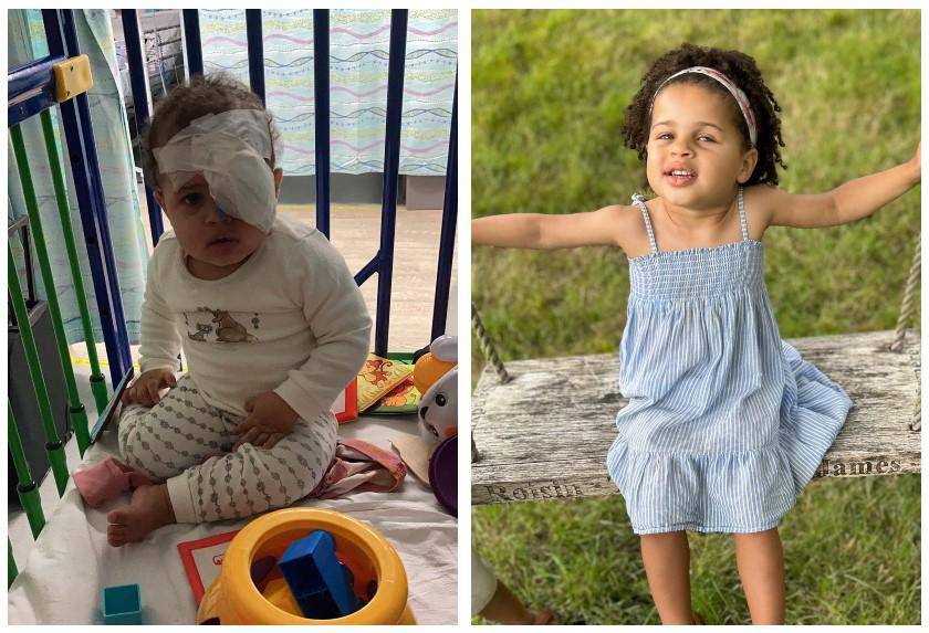 Bé gái sơ sinh đã bị ung thư mắt, 2 tuổi phải phẫu thuật 1 bên và những dấu hiệu không nên bỏ qua - 1